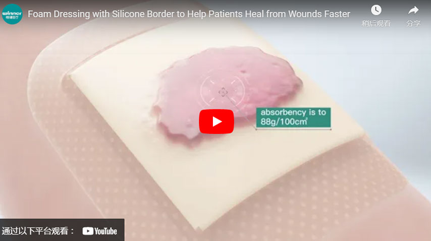 带硅胶边界的泡沫敷料帮助患者更快愈合伤口